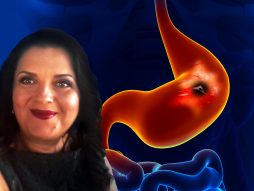 Dr Tatjana Radaljac, peptički ulkus, čir