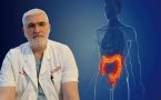 Zapaljenske bolesti creva, profesor Dino Tarabar