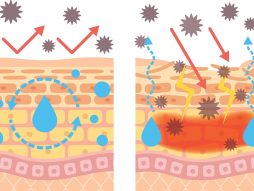 Dermatitis