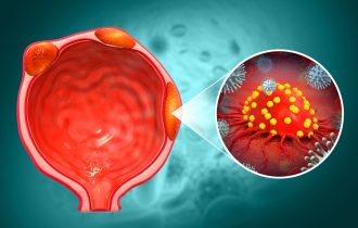 Besplatno, bez uputa i zakazivanja: 50+ razloga da uradite PSA test već danas