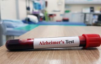 FDA odobrila prvi test krvi za dijagnozu Alchajmerove bolesti