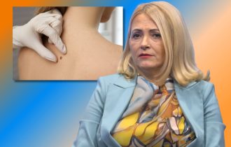 Melanom ne bira: Kako sunce i solarijumi utiču na našu kožu i život